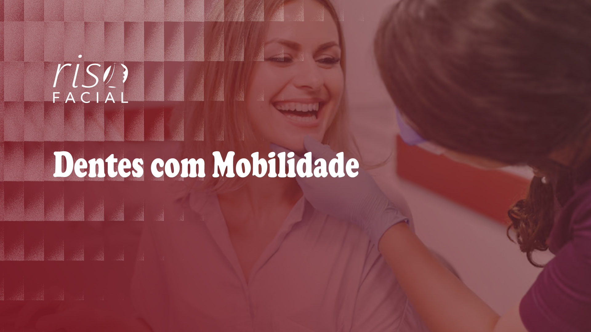 Imagem de capa: Dentes com Mobilidade