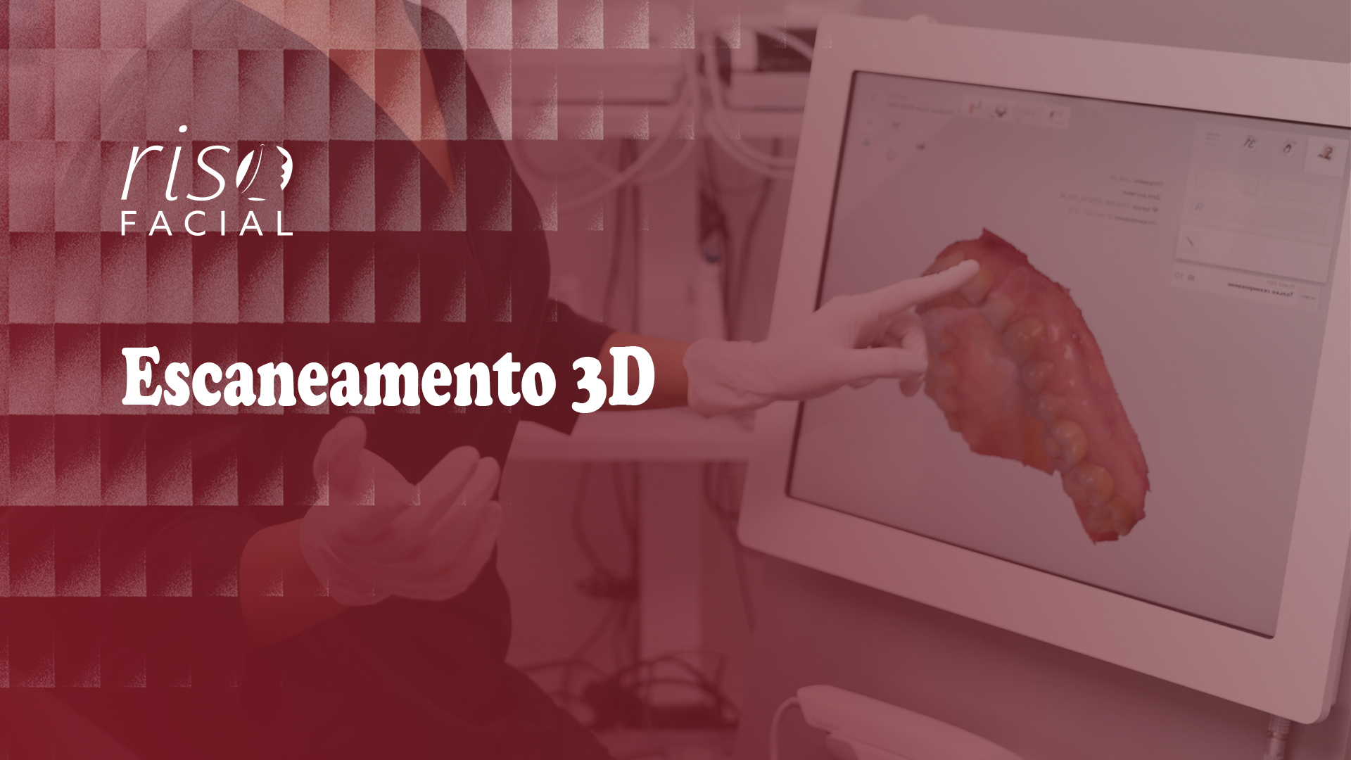 Imagem de capa: Escaneamento 3D
