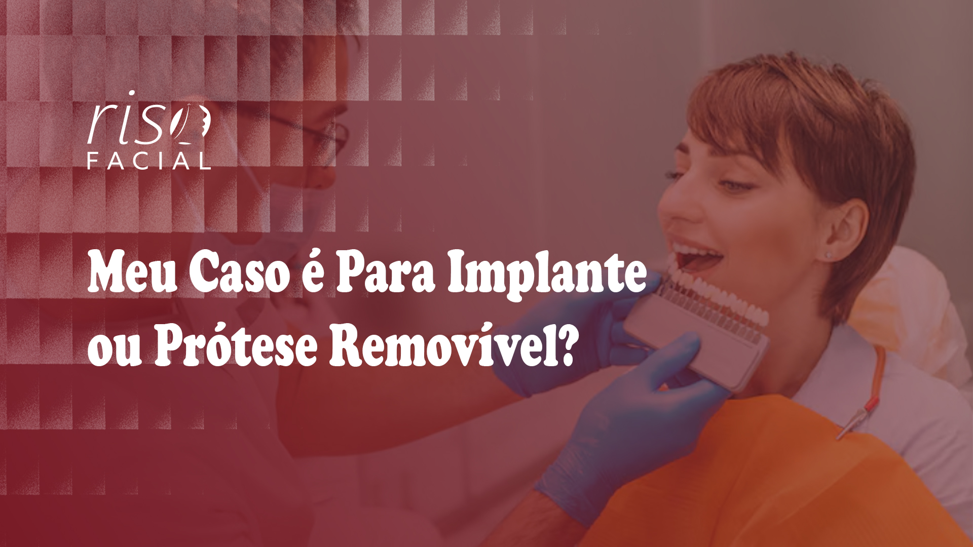Imagem de capa: Implante ou Prótese Removível