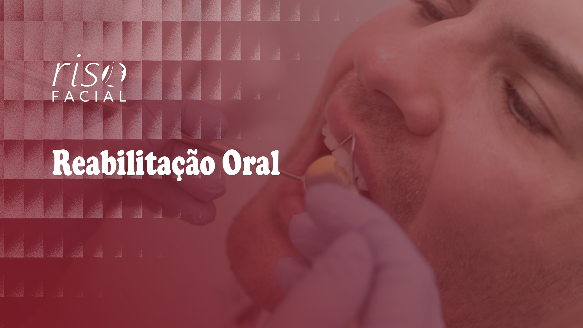 Imagem ilustrativa sobre reabilitação oral o que esperar das etapas do início ao fim