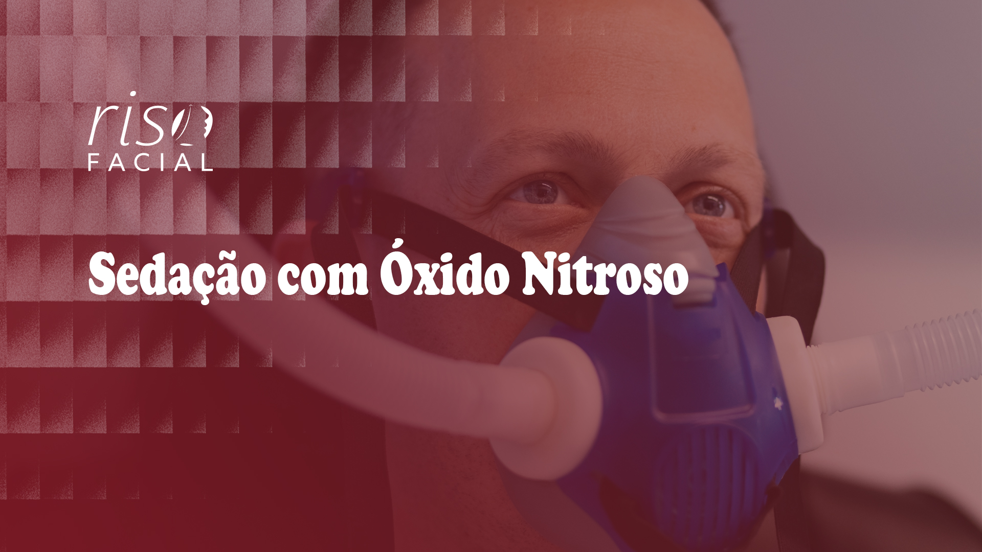 Imagem de capa: Sedação com Óxido Nitroso