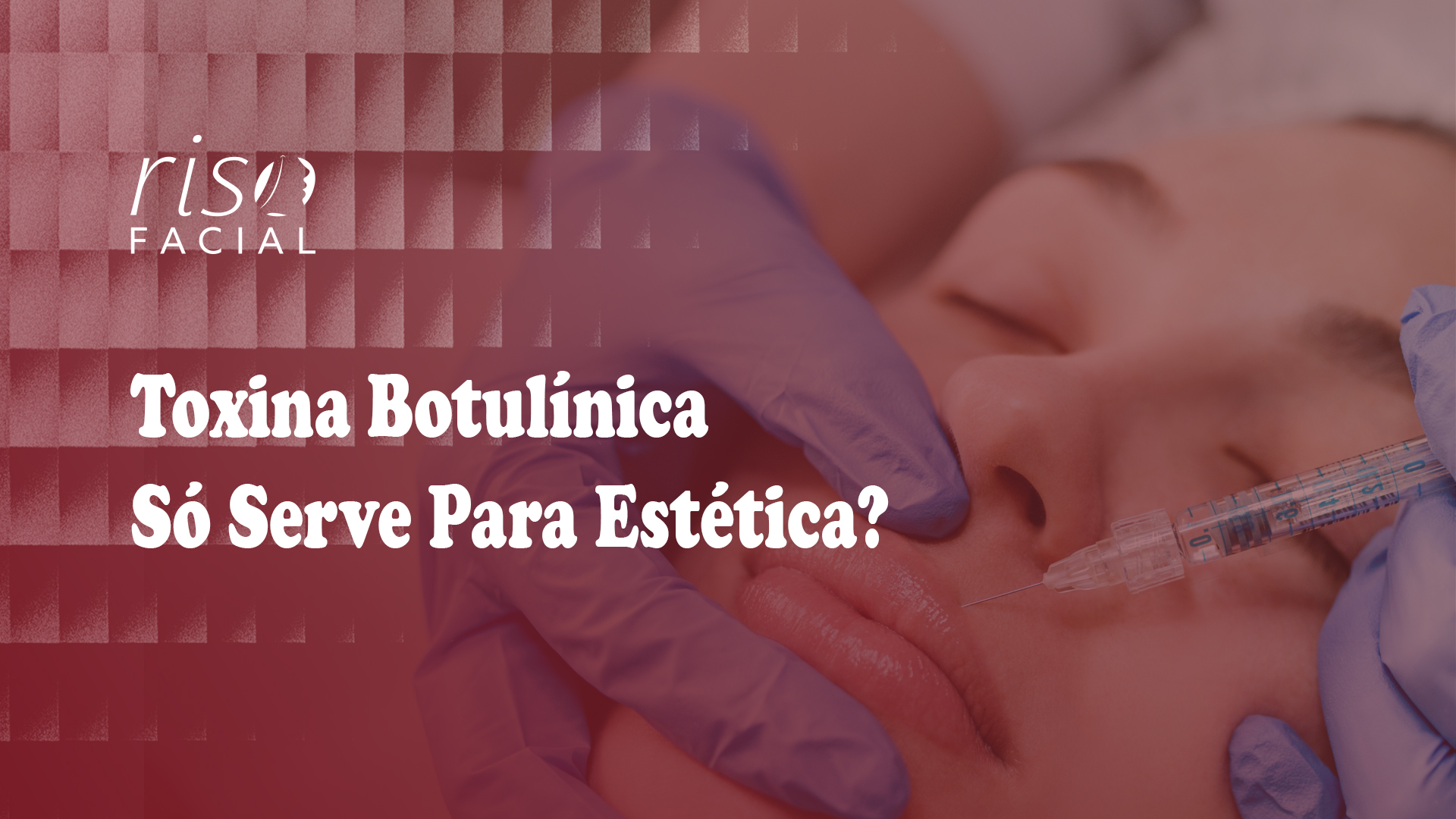 Imagem de capa: Toxina Botulínica Só Serve Para Estética