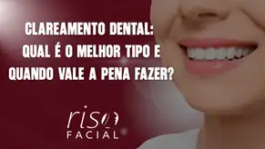 Sorriso branco após clareamento dental